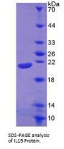 Human Interleukin 1 Beta (IL1b) Protein