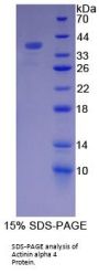 Human Actinin Alpha 4 (ACTN4) Protein