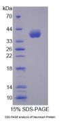 Human Neurocan (NCAN) Protein