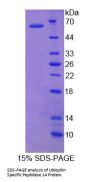 Human Ubiquitin Specific Peptidase 14 (USP14) Protein