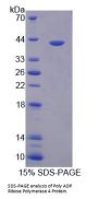 Human Poly ADP Ribose Polymerase 4 (PARP4) Protein