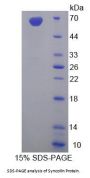 Human Syncoilin (SYNC) Protein