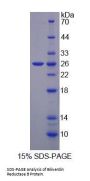 Human Biliverdin Reductase B (BLVRB) Protein