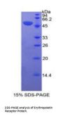 Human Erythropoietin Receptor (EPOR) Protein