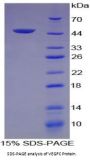 Human Vascular Endothelial Growth Factor C (VEGFC) Protein