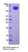 Human Fibrillin 2 (FBN2) Protein