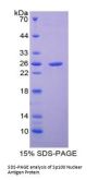 Human Sp100 Nuclear Antigen (Sp100) Protein