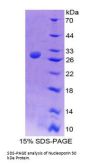 Human Nucleoporin 50 kDa (NUP50) Protein
