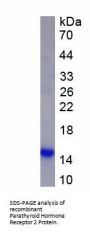 Human Parathyroid Hormone Receptor 2 (PTHR2) Protein