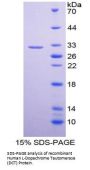 Human L-Dopachrome Tautomerase (DCT) Protein