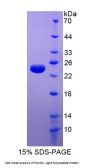 Human Ferritin, Light Polypeptide (FTL) Protein