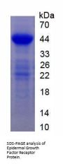 Human Epidermal Growth Factor Receptor (EGFR) Protein