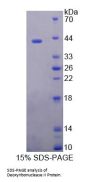 Human Deoxyribonuclease II (DNASEII) Protein