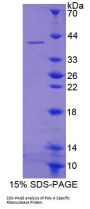 Human Poly A Specific Ribonuclease (PARN) Protein