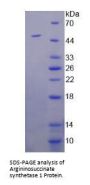 Human Argininosuccinate Synthetase 1 (ASS1) Protein