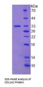 Human Collagen Type I Alpha 2 (COL1A2) Protein