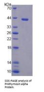 Human Prothymosin Alpha (PTMa) Protein