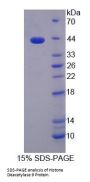 Human Histone Deacetylase 9 (HDAC9) Protein