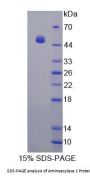 Human Aminoacylase 1 (ACY1) Protein
