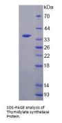 Human Thymidylate Synthase (TYMS) Protein