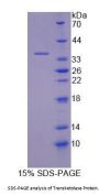 Human Transketolase (TKT) Protein