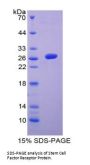 Human Mast/Stem Cell Growth Factor Receptor Kit (KIT) Protein