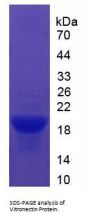 Human Vitronectin (VTN) Protein