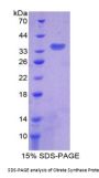 Human Citrate Synthase (CS) Protein