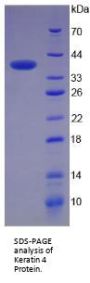Human Keratin 4 (KRT4) Protein