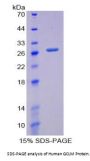 Human Glutamate Cysteine Ligase, Modifier Subunit (GCLM) Protein