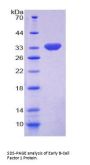 Human Early B-Cell Factor 1 (EBF1) Protein
