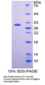 Human V-Fos FBJ Murine Osteosarcoma Viral Oncogene Homolog (FOS) Protein