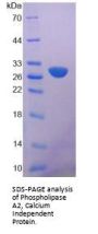 Human 85 KDa Calcium-Independent Phospholipase A2 (PLA2G6) Protein