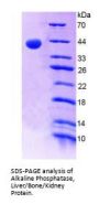 Human Alkaline Phosphatase, Tissue-Nonspecific Isozyme (ALPL) Protein