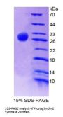Human Prostaglandin E Synthase 2 (PTGES2) Protein