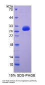 Human Immunoglobulin Superfamily, Member 2 (IGSF2) Protein