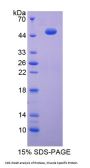 Human Enolase, Muscle Specific (MSE) Protein