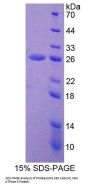 Human 26S Proteasome Non-ATPase Regulatory Subunit 5 (PSMD5) Protein