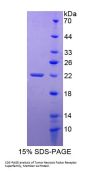 Human Tumor Necrosis Factor Receptor Superfamily, Member 14 (TNFRSF14) Protein