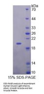Human Myosin Light Chain 6, Alkali, Smooth Muscle And Non Muscle (MYL6) Protein