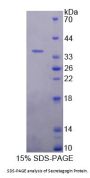 Human Secretagogin (SCGN) Protein