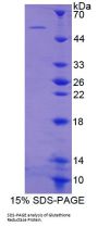 Human Glutathione Reductase (GR) Protein