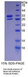 Human Basal Cell Adhesion Molecule (BCAM) Protein