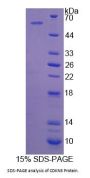 Human Cyclin Dependent Kinase Inhibitor 3 (CDKN3) Protein
