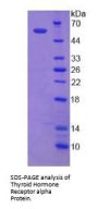 Human Thyroid Hormone Receptor Alpha (THRa) Protein