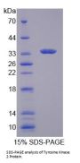Human Tyrosine Kinase 2 (TYK2) Protein
