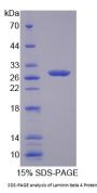 Human Laminin Beta 4 (LAMb4) Protein