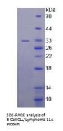 Human B-Cell CLL/Lymphoma 11A (Bcl11A) Protein