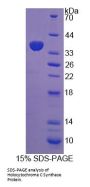 Human Holocytochrome C Synthase (HCCS) Protein