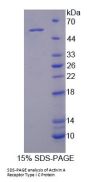Human Activin A Receptor Type 1C (ACVR1C) Protein